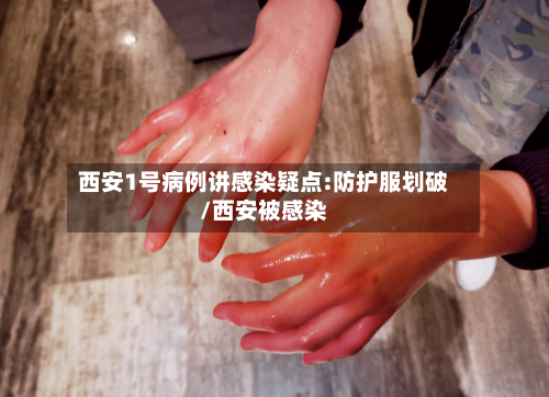 西安1号病例讲感染疑点:防护服划破/西安被感染